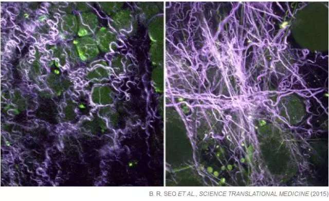 20151023101444 85e64