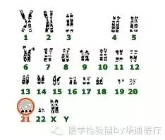 215135256 f770b