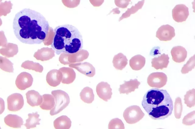 3 a1c49